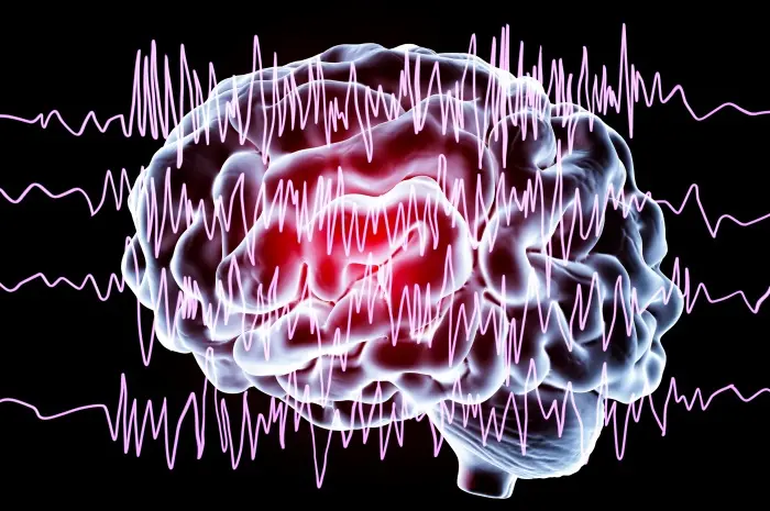 Lasers, Robots, and Tiny Electrodes are Transforming Treatment of Severe Epilepsy